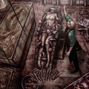 Splitting - Sculpting Fetal Chunks i gruppen CD / Kommende / Metal hos Bengans Skivbutik AB (5649323)