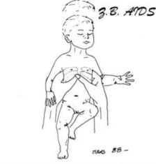 Z.B. Aids - Gestalt