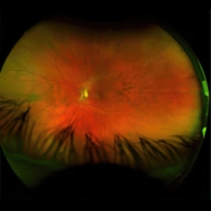 Puciato Greg - Mirrorcell (Black & Grey Splatter)