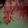 Remote Viewing - Blood Loss Remote Viewing - Blood Loss